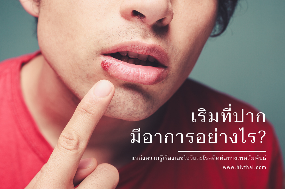 โรคเริม เริมที่ปาก ยารักษาเริม อาการเริมที่ปาก เริมที่ปากหายไหม สาเหตุเริมที่ปาก รักษาเริมที่ปาก